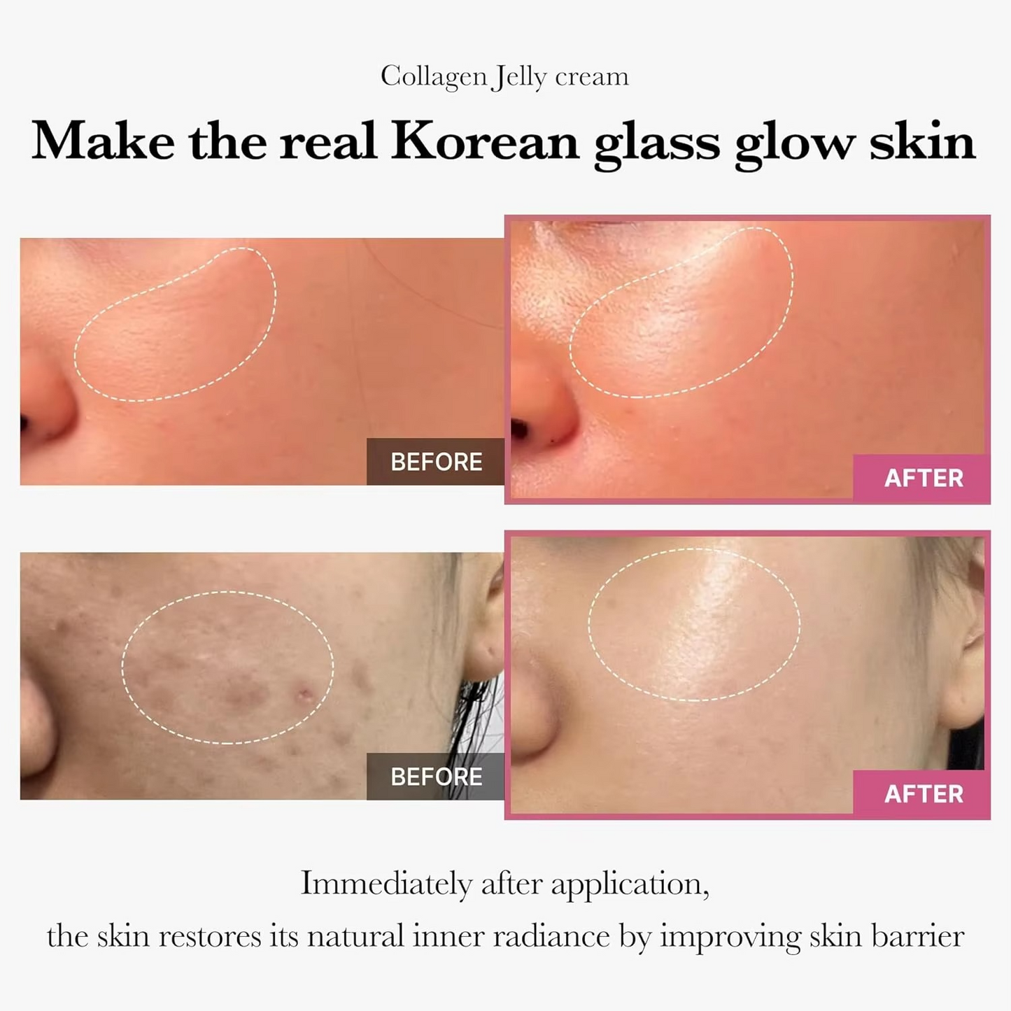 Medicube Collagen Jelly Cream- Niacinamide & Freeze-Dried Hydrolyzed Collagen