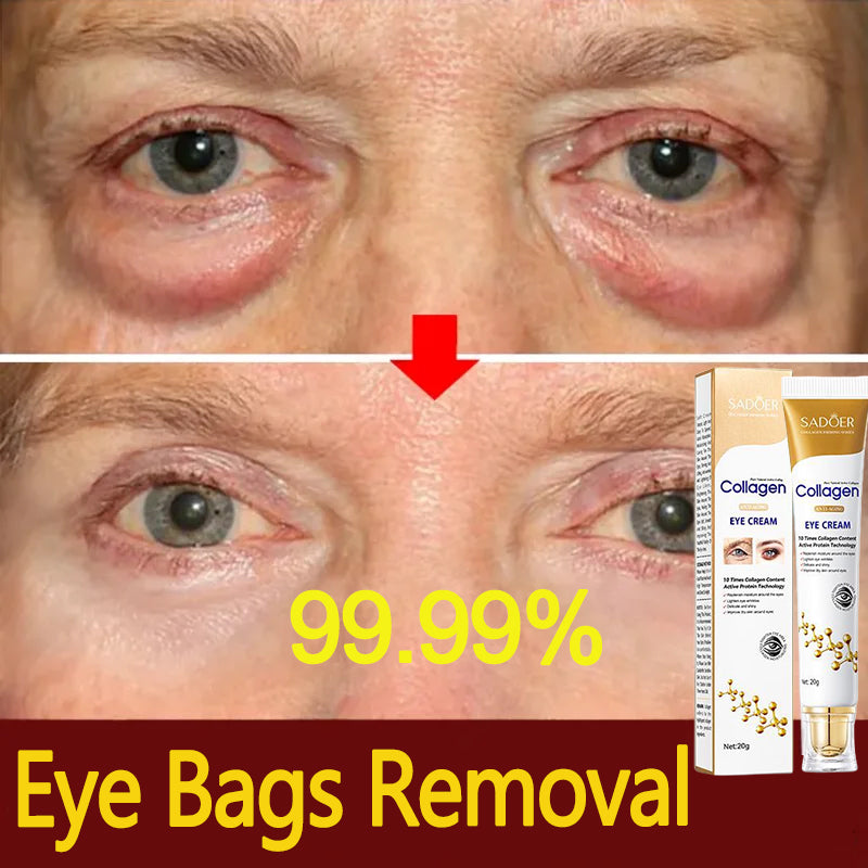 Collagen Anti Aging Eye Cream Best Repair for Dark Circles and Instant Eye Bag Removal