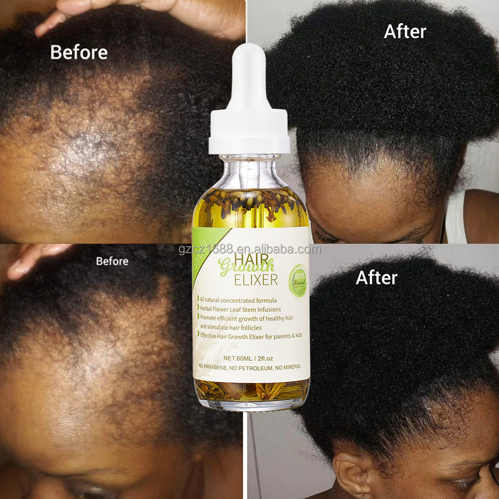 100% Natural Organic Hair Growth Elixir with Rosemary, Castor, Almond Oil Men Women Scalp Care Serum Hair Treatment Growth Oil