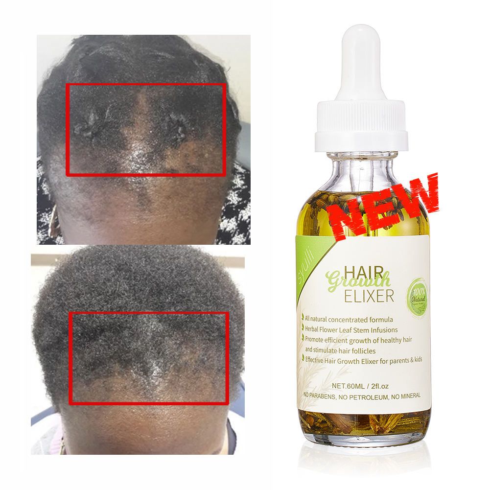 100% Natural Organic Hair Growth Elixir with Rosemary, Castor, Almond Oil Men Women Scalp Care Serum Hair Treatment Growth Oil